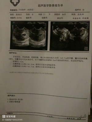 怀孕初期流血怎么办