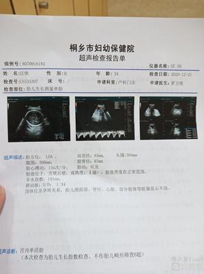 孕三十三周是几个月