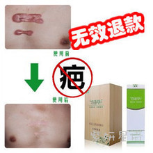 中药去疤痕