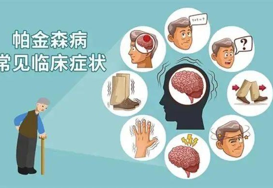 帕金森怎么治疗效果好