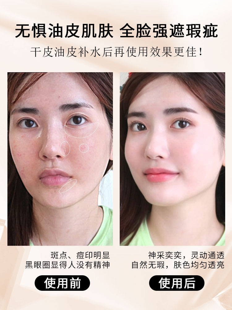 有痘痘痘印的怎么化妆