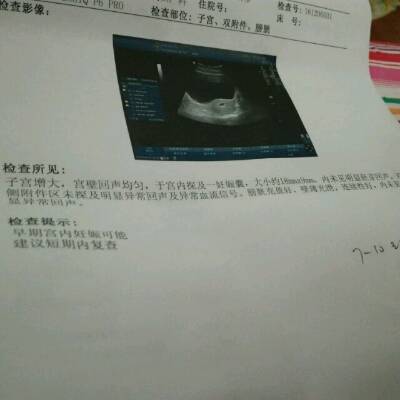 怀孕后要做什么检查