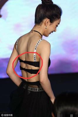 后背心疼是怎么回事