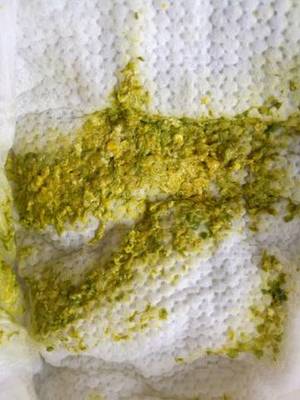 宝宝拉蛋花样大便