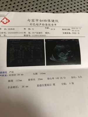 怀孕了怎么看男女