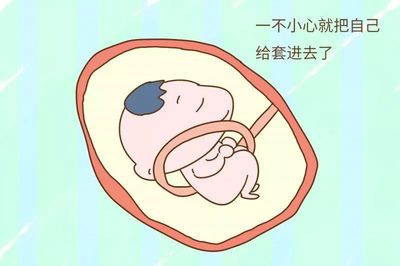 胎儿胎位什么时候固定