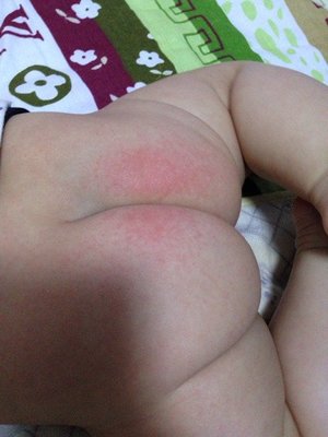 小便是红的是怎么回事