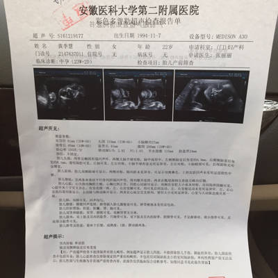 小排畸有宝宝照片吗