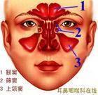 喉咙里有囊肿怎么治疗