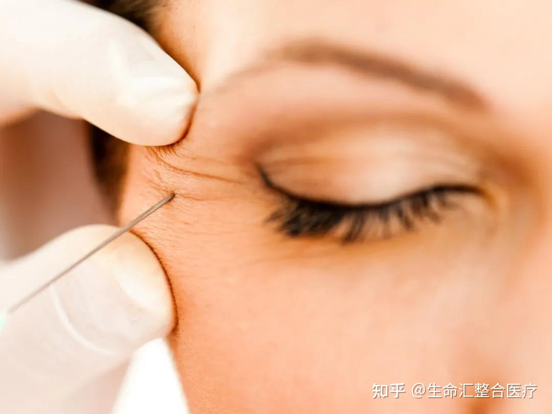 眼痉挛怎么治疗