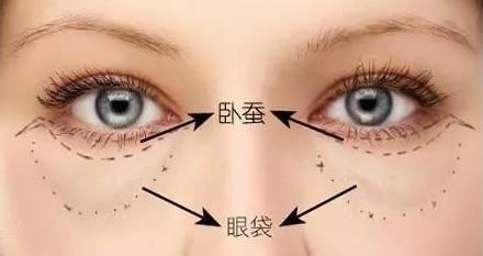 眼袋大是怎么回事