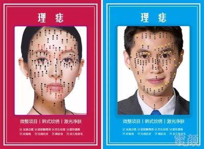 可以祛痣吗