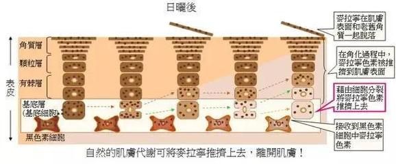 药物祛斑后反黑