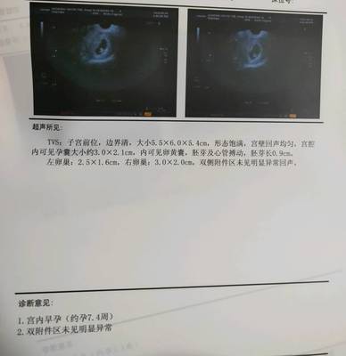 反胃肚子疼想吐是怎么回事