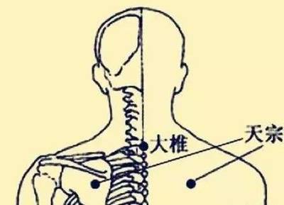 后背胀是怎么回事
