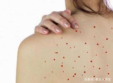 背后长痘痘用什么