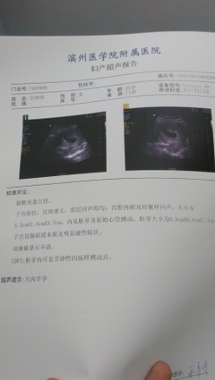 怀孕两天会恶心吗