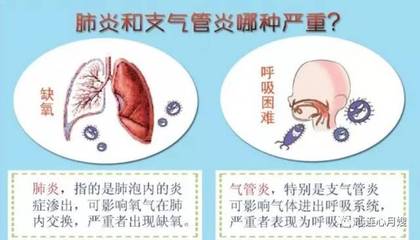 支气管发炎咳嗽
