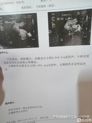 怀孕五周肚子疼是怎么回事