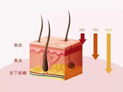 皮秒激光可以祛痘印吗