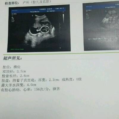 33周胎儿发育情况