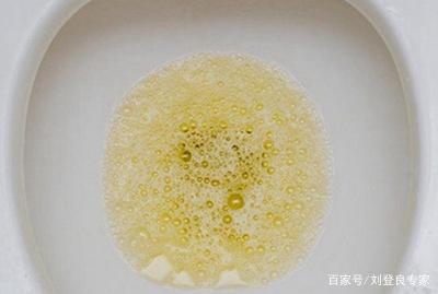 小便混沌是怎么回事