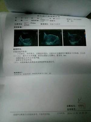 女生白带多是怀孕了吗