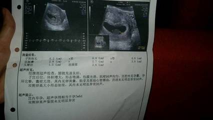 怀孕8周胎芽多大正常