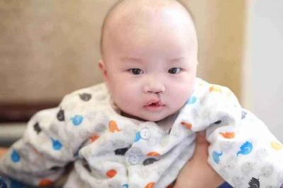 胎儿兔唇是什么原因造成的
