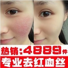 脸部角质层增厚