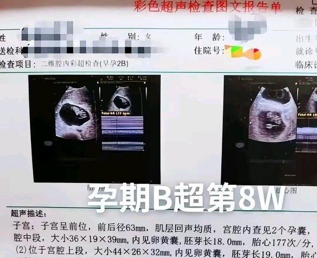 假怀孕