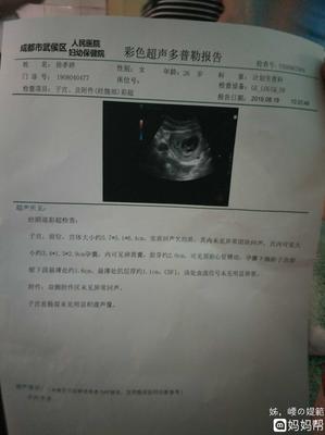 流产多久能怀孕