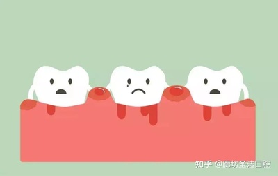 牙根出血是怎么回事