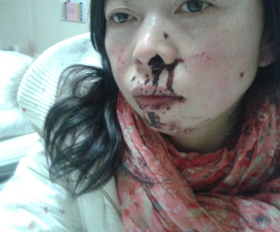 女人梦见自己流血