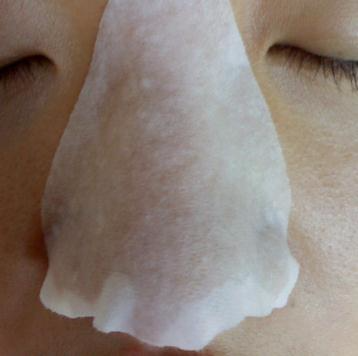 挤痘痘 冻膜
