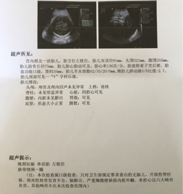 胎儿生下来多少斤正常