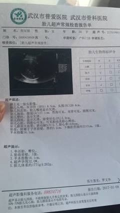 孕32周出血是怎么回事