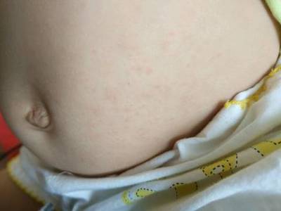 9个月宝宝能吃菠萝吗