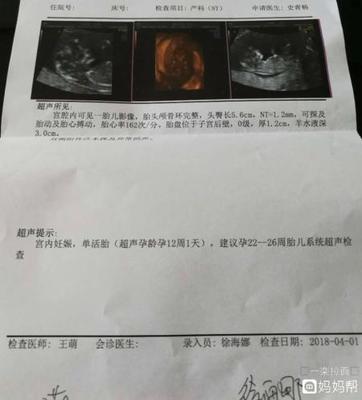 怀孕26周胎儿有多大