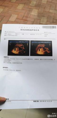 怀孕8周胎芽多大正常