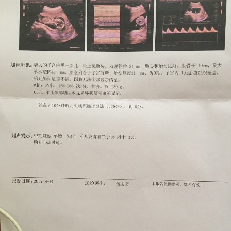 胎儿心跳太快怎么回事