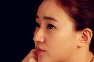 女人鼻梁有节什么命