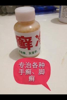 怀孕治脚气的土方法