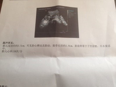胎儿几个月有胎动正常