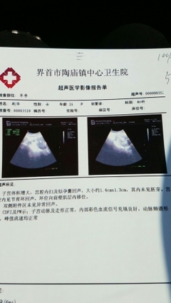 请问上环会怀孕吗