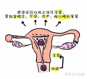 有妇科炎症可以怀孕吗