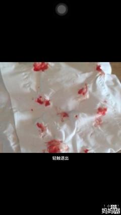 流鼻血有血块是怎么回事