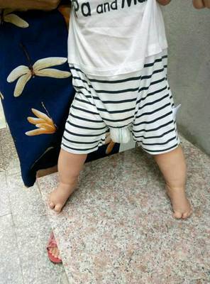 五个月宝宝站立时总脚尖着地