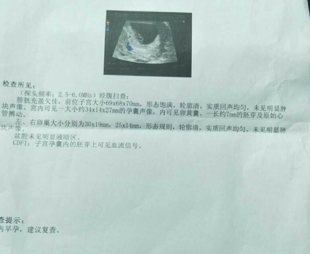 孕吐越厉害胎儿越稳定