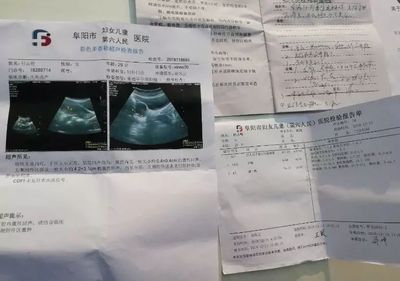 两个月孕妇出血是怎么回事